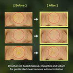 [Anua] Huile Nettoyante Contrôle de Pores Heartleaf